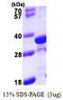 SDS-PAGE gel of recombinant human TPM4 protein 3µg under reducing conditions with Coomassie blue staining