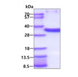 SDS-PAGE gel of recombinant human 17 beta-HSD8 HSD17B8 protein under reducing conditions