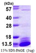 SDS-PAGE gel of recombinant human DYNLL2 protein 3µg under reducing conditions Coomassie blue stain