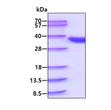 SDS-PAGE gel of recombinant human CDK2 protein stained with Coomassie blue