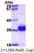 SDS-PAGE gel of recombinant human MYL6B protein under reducing conditions Coomassie blue stain
