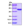 SDS-PAGE gel of recombinant human PSMA1 protein 3ug under reducing conditions with Coomassie blue stain