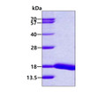 SDS-PAGE gel showing recombinant human UbcH5d UBE2D4 protein 3μg under reducing conditions Coomassie blue stain