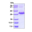 SDS-PAGE gel of recombinant human RAB32 protein stained with Coomassie blue