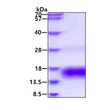 SDS-PAGE of recombinant human Betacellulin protein under reducing conditions stained with Coomassie blue