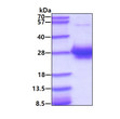 SDS-PAGE of recombinant human alpha 1-Microglobulin protein under reducing conditions