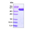 SDS-PAGE of recombinant human p38 gamma MAPK12 protein under reducing conditions