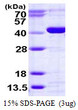 SDS-PAGE gel of recombinant human CANT1 protein 3µg under reducing conditions Coomassie stain