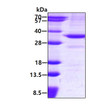 SDS-PAGE of recombinant human BDH1 protein under reducing conditions with Coomassie blue stain