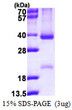 SDS-PAGE gel of recombinant human CCND2 protein under reducing conditions stained with Coomassie blue