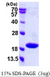 SDS-PAGE gel of recombinant human p18INK4c CDKN2C protein under reducing conditions