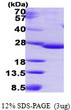 SDS-PAGE gel of recombinant human IDNK gluconokinase protein under reducing conditions
