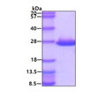 SDS-PAGE gel of recombinant human ABHD14B protein under reducing conditions Coomassie blue stain