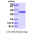 SDS-PAGE gel of recombinant human UNC119B protein under reducing conditions stained with Coomassie blue