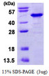 SDS-PAGE gel of recombinant human IkB-beta protein under reducing conditions