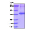 SDS-PAGE of recombinant human Casein beta CSN2 protein under reducing conditions
