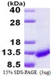 SDS-PAGE gel of recombinant human CARD18 protein under reducing conditions stained with Coomassie blue
