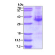 Recombinant human VPS22 SNF8 protein SDS-PAGE gel under reducing conditions stained with Coomassie blue