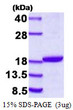 SDS-PAGE gel of recombinant human DSTN protein under reducing conditions stained with Coomassie blue