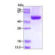 SDS-PAGE gel of recombinant human ACADSB protein under reducing conditions