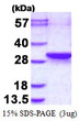SDS-PAGE gel electrophoresis of recombinant human LDOC1L RTL6 protein under reducing conditions