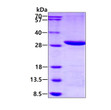 SDS-PAGE gel of recombinant human LYPLAL1 protein under reducing conditions stained with Coomassie blue