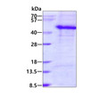 SDS-PAGE gel showing recombinant human DKK3 protein under reducing conditions stained with Coomassie blue