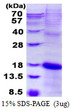 SDS-PAGE of recombinant human NKG2C KLRC2 protein under reducing conditions
