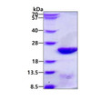 SDS-PAGE gel of recombinant human UbcH10 UBE2C protein under reducing conditions stained with Coomassie blue