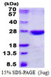 SDS-PAGE gel of recombinant human NHEJ1 protein under reducing conditions with Coomassie blue stain