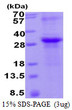 SDS-PAGE gel of recombinant human TIMP-2 protein 3µg under reducing conditions Coomassie blue stain