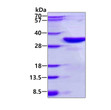 SDS-PAGE of recombinant human DKK2 protein under reducing conditions Coomassie blue stain
