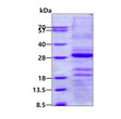 SDS-PAGE gel of recombinant human Gastrokine 1 GKN1 protein under reducing conditions
