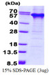 SDS-PAGE gel of recombinant human TDG protein 3ug under reducing conditions Coomassie blue stain