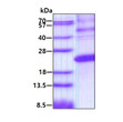 SDS-PAGE of recombinant human Endocan ESM1 protein under reducing conditions