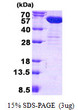 SDS-PAGE gel of recombinant human CNDP2 CPGL protein under reducing conditions Coomassie blue stain