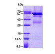 SDS-PAGE gel showing 3ug recombinant human Lyn protein under reducing conditions with Coomassie blue stain