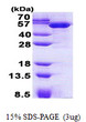 SDS-PAGE gel of recombinant human TBCEL protein under reducing conditions