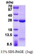 SDS-PAGE gel of recombinant human DNAL1 protein under reducing conditions stained with Coomassie blue