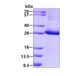 SDS-PAGE gel of recombinant human KCTD11 protein 3ug Coomassie blue stain reducing