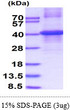 SDS-PAGE of recombinant human Biglycan protein under reducing conditions with Coomassie blue stain