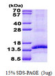 SDS-PAGE gel of recombinant human CD3 gamma protein under reducing conditions stained with Coomassie blue