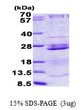 SDS-PAGE gel of recombinant human RPL23A protein 3ug under reducing conditions