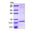 Recombinant human RAB8B protein SDS-PAGE gel 3 μg Coomassie blue stain