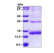 SDS-PAGE gel of recombinant human RPS19 protein 3ug under reducing conditions Coomassie blue stain