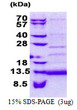 SDS-PAGE gel of recombinant human CD59 protein under reducing conditions stained with Coomassie blue