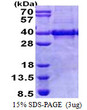 SDS-PAGE gel showing recombinant human MYOZ1 protein 3 µg under reducing conditions Coomassie blue stain
