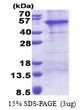 SDS-PAGE of recombinant human AP1AR protein under reducing conditions