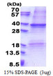 SDS-PAGE of recombinant human GM-CSF R alpha protein under reducing conditions