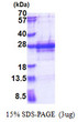 SDS-PAGE gel of recombinant human PP1 Inhibitor-2 protein under reducing conditions